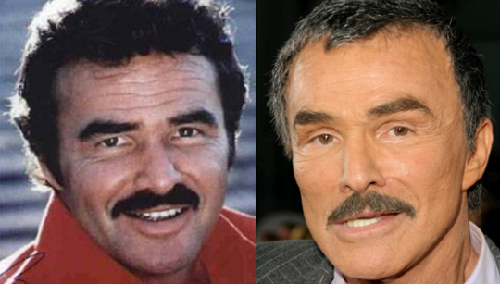 Burt-Reynolds-Before-And-After