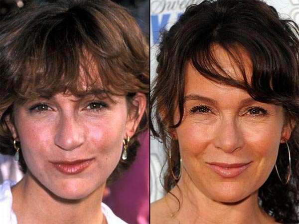Jennifer-Grey-Plastic-Surgery-Before-After