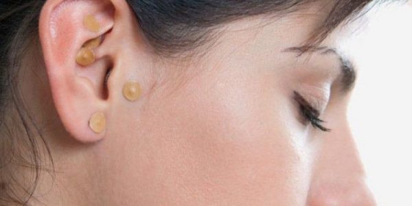 Auriculoterapia-para-adelgazar2.-750x375