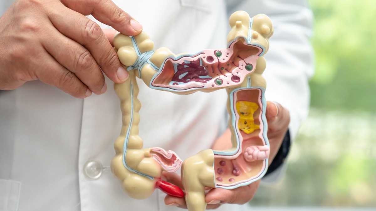 archivo infogate web-5-2-34-7