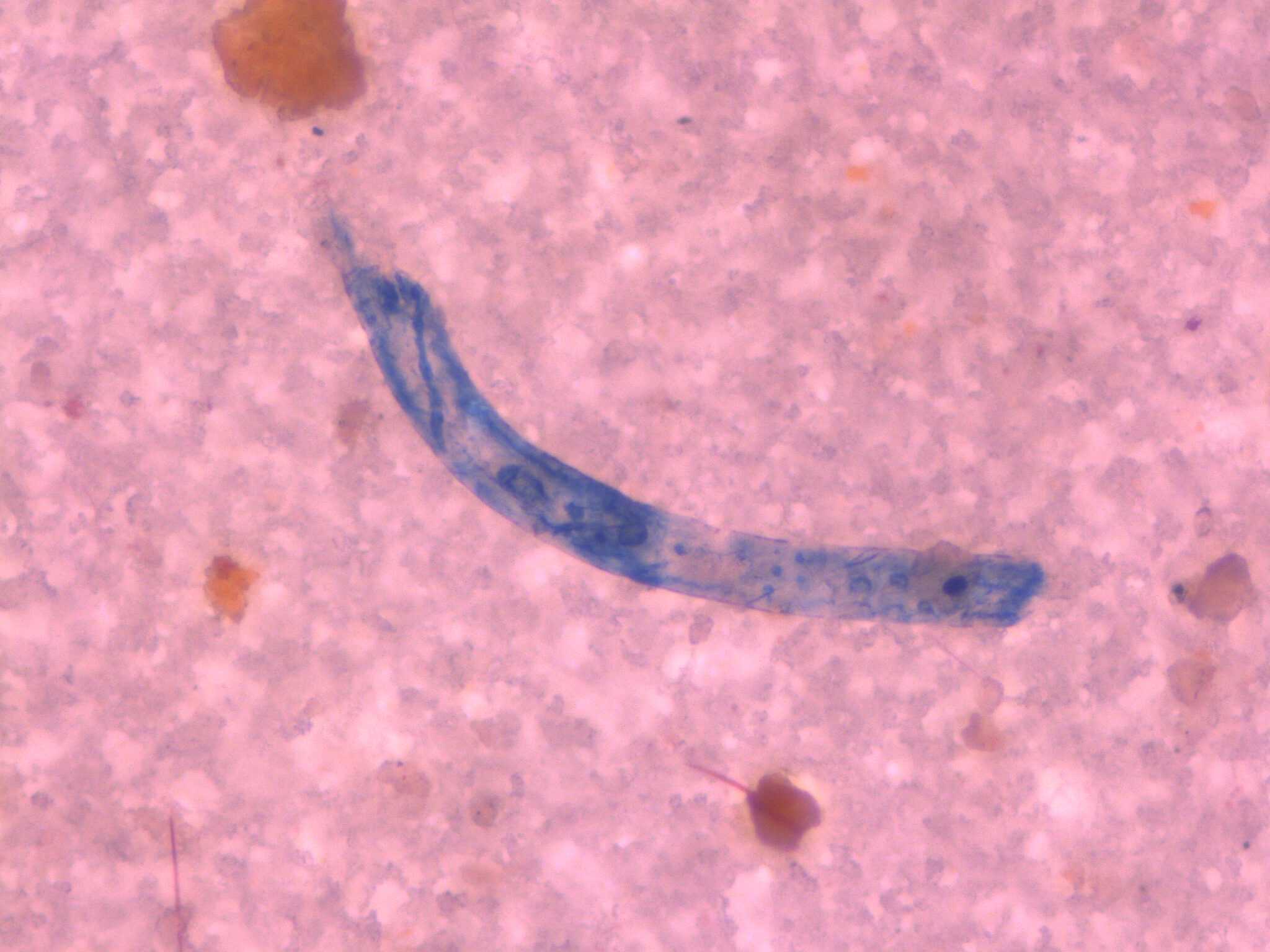 plasticoantarticaalmeja