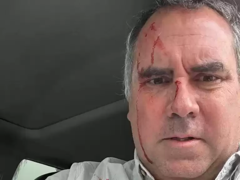 Candidato_Peru_Atentado-e1764695420258