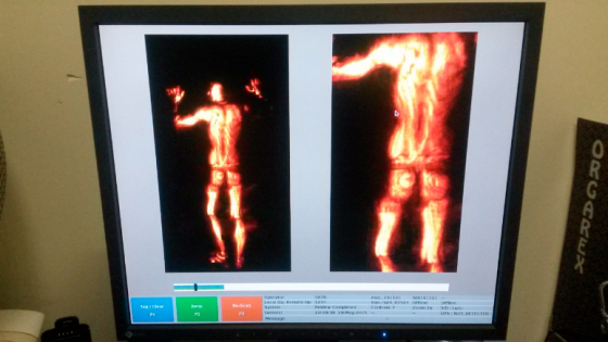 Imagen-escáner-socofar-1-e1435957990767