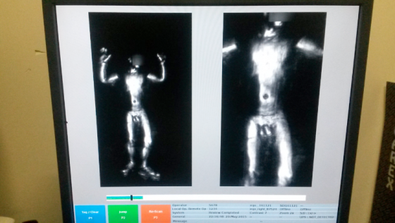 Imagen-escáner-socofar-2-e1435958001889