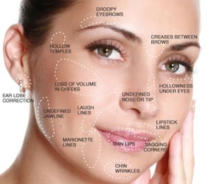 Medical-Sodium-Hyaluronate-Gel-Hyaluronic-Acid-Dermal