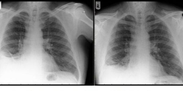 acude-al-mdico-pensando-que-tena-un-tumor-pero-slo-era-un-playmbilh.jpg.imgw.1280.1280